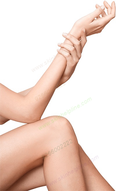
Contact SkinHelpline for Permanent Laser Hair Removal
